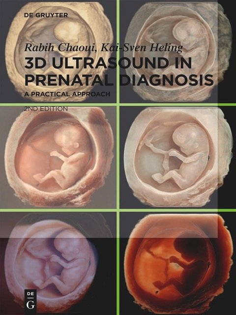 3D Ultrasound in Prenatal Diagnosis A Practical Approach