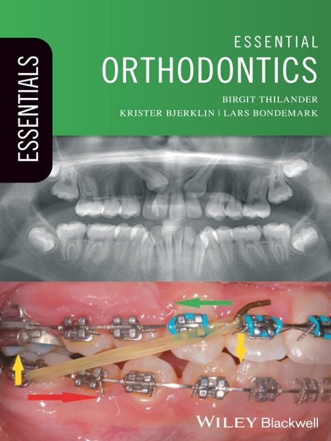 Essential Orthodontics (Essentials (Dentistry))