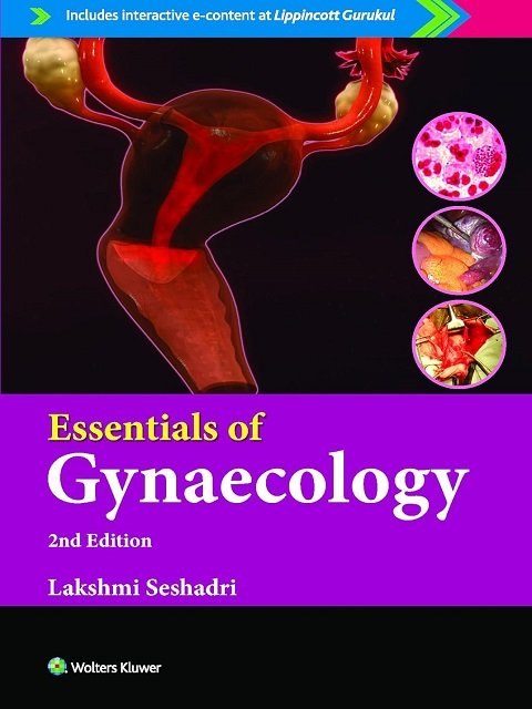 Essentials of Gynaecology, 2ed.