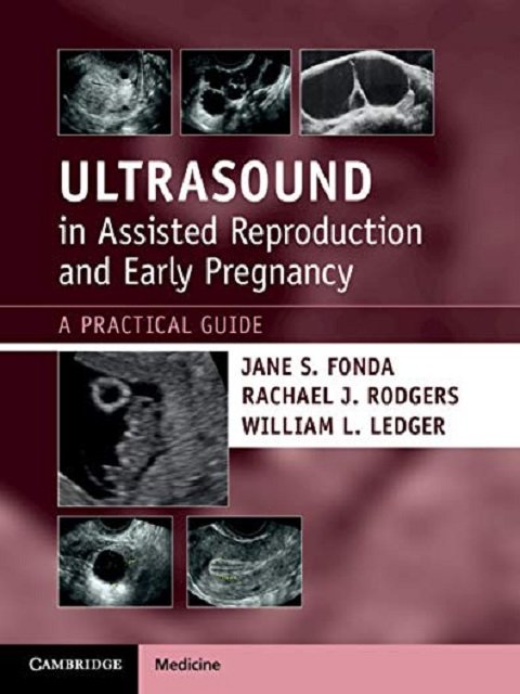 Ultrasound in Assisted Reproduction and Early Pregnancy A Practical Guide.