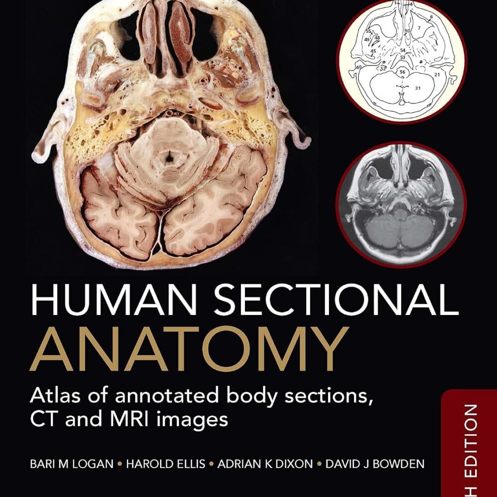 Human Sectional Anatomy.