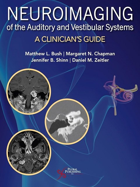 Neuroimaging of the Auditory and Vestibular Systems A Clinician’s Guide.